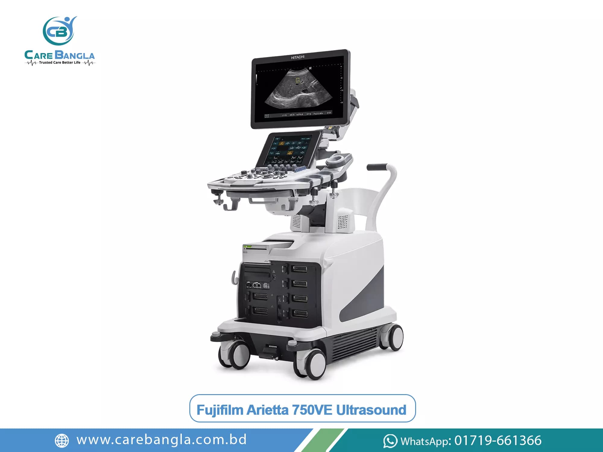 Fujifilm Arietta 750VE Ultrasound Price in Bangladesh — Fujifilm Arietta 750VE high-end ultrasound console with large display and control panel