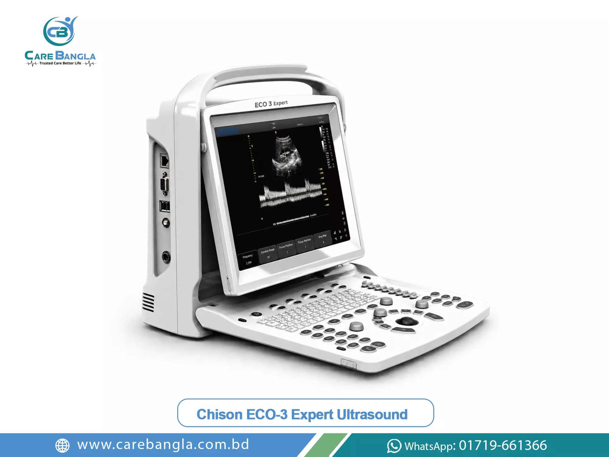 Chison ECO-3 Expert Ultrasound Price in Bangladesh — Chison ECO-3 Expert portable colour ultrasound showing a spectral Doppler trace on its folding display