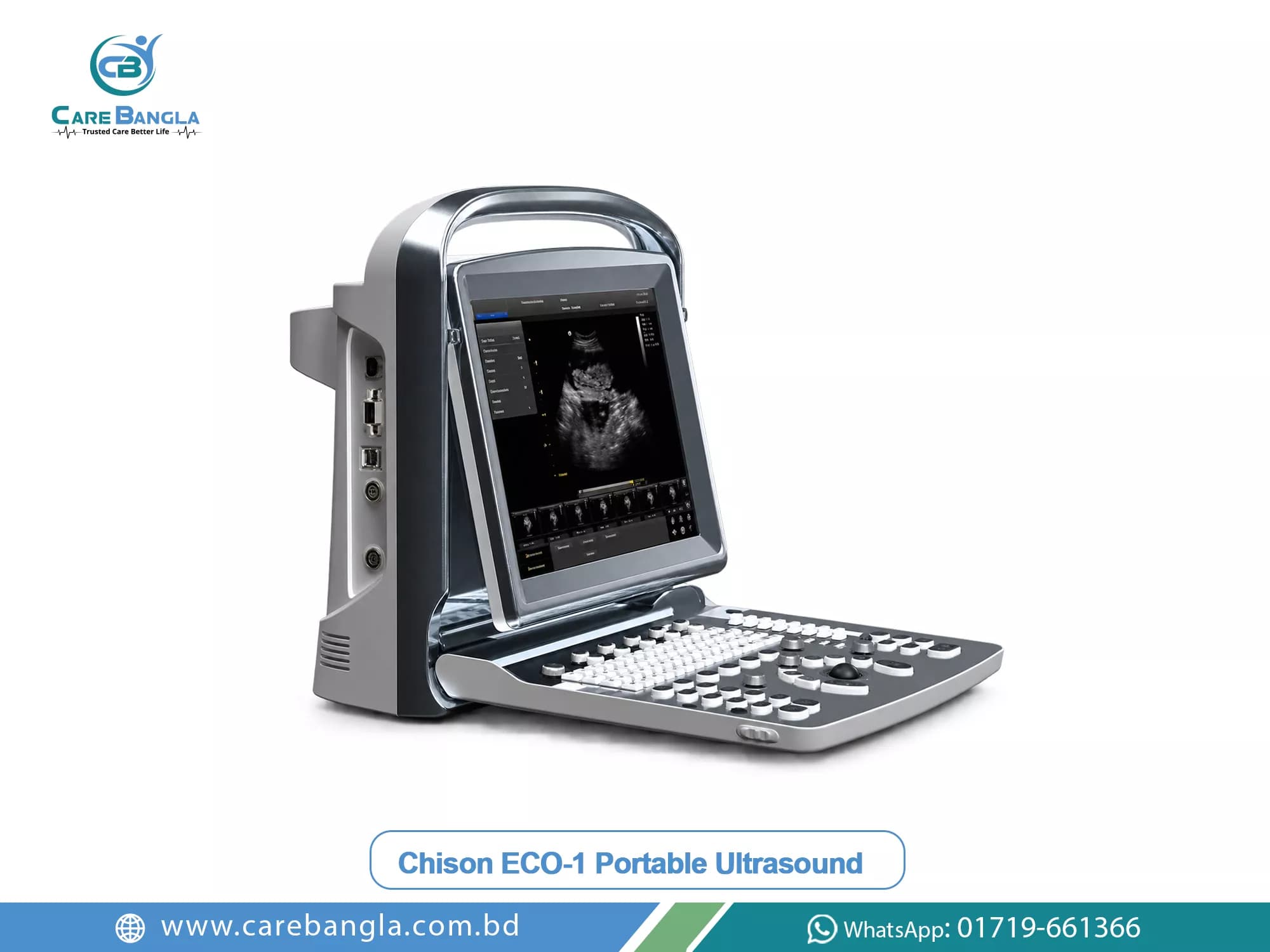 Chison ECO-1 Portable Ultrasound Price in Bangladesh Chison ECO-1 Portable Ultrasound Price in Bangladesh — Chison ECO-1 laptop-style portable ultrasound with folding display showing a black and white image